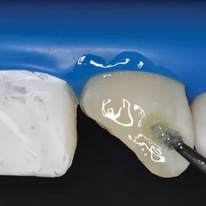 SafeEndo ReCreate Bond 7 (7th Gen Bonding Agent) - Image 4
