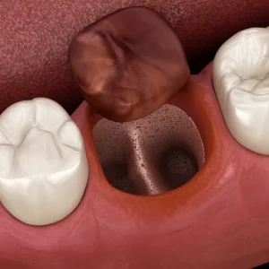 SafeEndo Socket Cure - Image 4