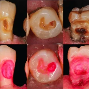 SafeEndo Explore - Image 4