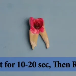 SafeEndo Explore - Image 3