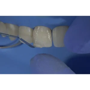 GDC Restore Instrument - Applica - Image 3