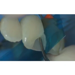 GDC Restore Instrument - Condensa - Image 3