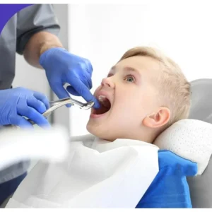 GDC Extraction Forceps Upper Molars Pedo Standard (FX6CS) - Image 4