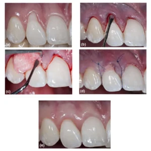 GDC Tunneling Knife 1 - 6 (TKN1) - Image 3